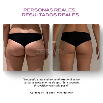 CeluLift Pro + Crema de Regalo